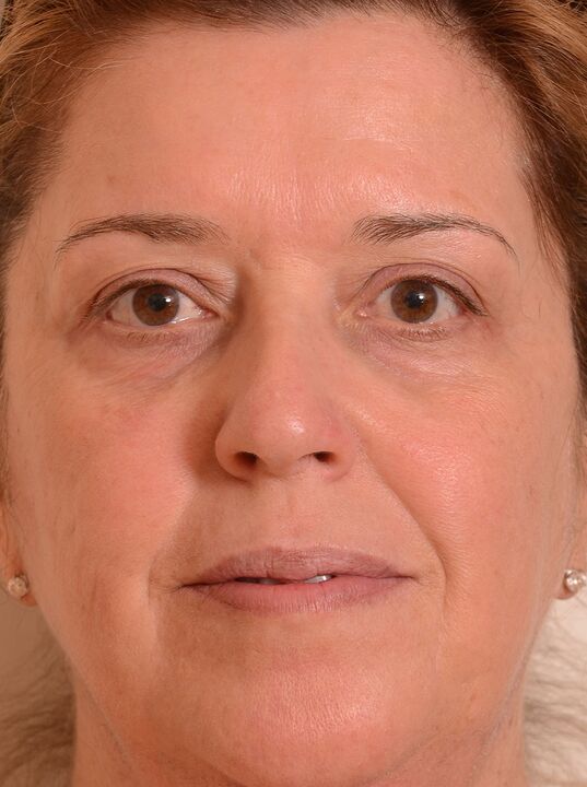 Αναζωογόνησα το πρόσωπό μου με κρέμα Eudalie