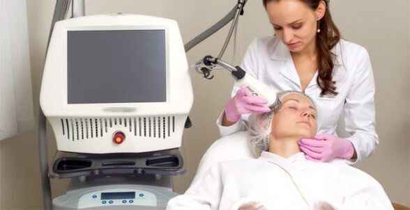 Εφαρμογή της διαδικασίας